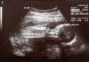 trimester kedua masa hamil kehamilan ibu hamil - 1