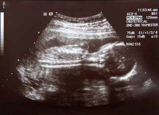 Trimester Kedua Masa Hamil yang Menakjubkan trimester kedua masa hamil kehamilan ibu hamil - 1
