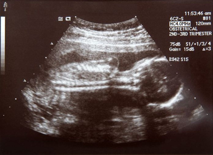 trimester kedua masa hamil kehamilan ibu hamil - 1
