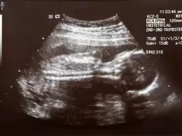 trimester kedua masa hamil kehamilan ibu hamil - 1